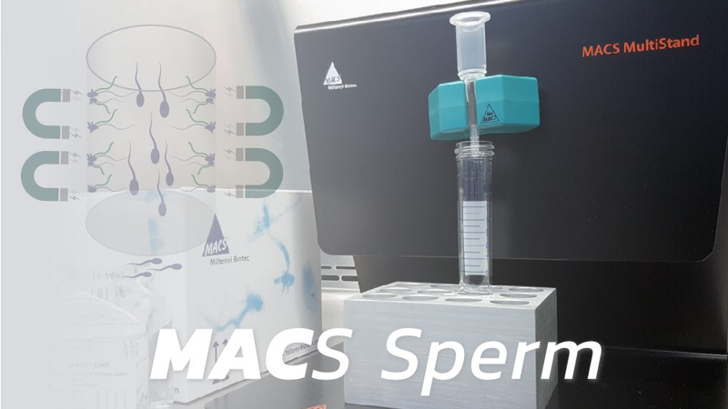 MACS Sperm