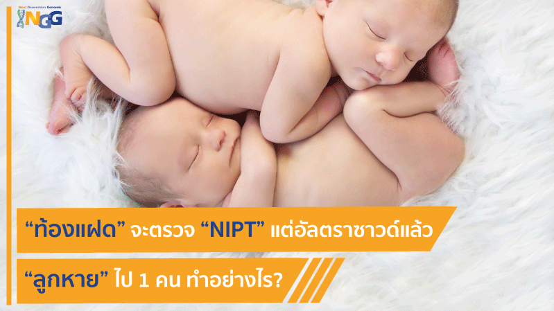 ท้องแฝด จะตรวจ NIPT แต่อัลตราซาวด์แล้วลูกหายไป 1 คน ทำอย่างไร?