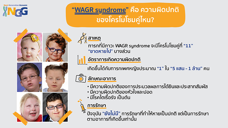 WAGR syndrome คือความผิดปกติของโครโมโซมคู่ไหน?