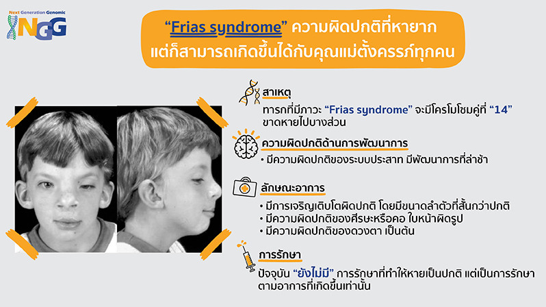Frias syndrome ความผิดปกติที่หายาก แต่ก็สามารถเกิดขึ้นได้กับคุณแม่ตั้งครรภ์ทุกคน