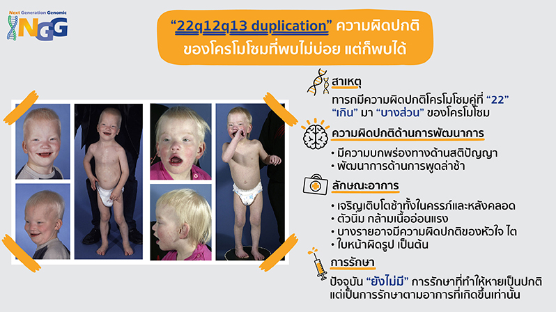 22q12q13 duplication ความผิดปกติโครโมโซมที่พบไม่บ่อย แต่ก็พบได้