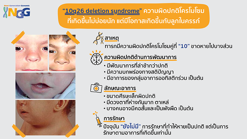 10q26 deletion syndrome ความผิดปกติโครโมโซมที่เกิดขึ้นไม่บ่อยนัก แต่มีโอกาสเกิดขึ้นกับลูกในครรภ์