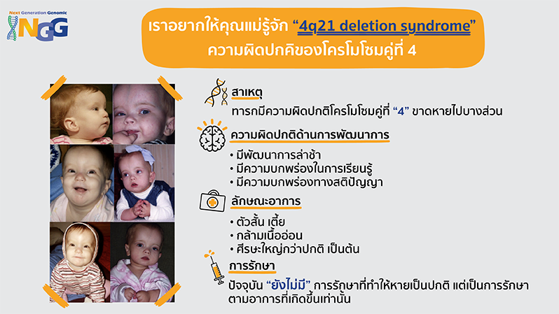 เราอยากให้คุณแม่รู้จัก 4q21 deletion syndrome ความผิดปกคิของโครโมโซมคู่ที่ 4