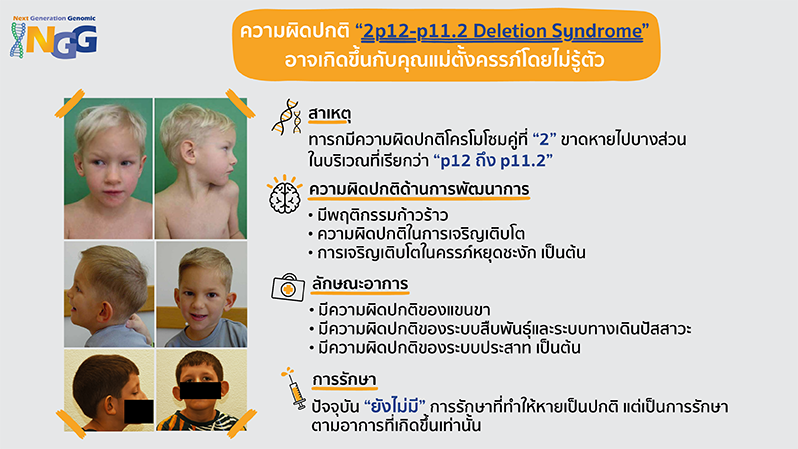 ความผิดปกติ 2p12-p11.2 deletion syndrome อาจเกิดขึ้นกับคุณแม่ตั้งครรภ์โดยไม่รู้ตัว
