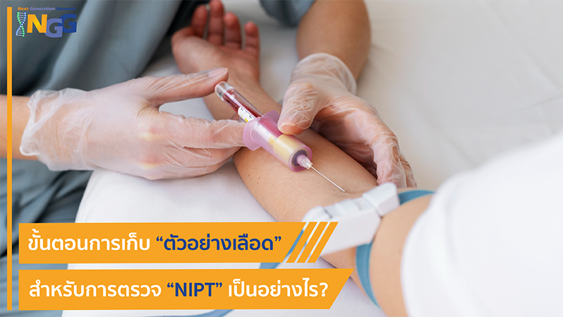 ขั้นตอนการเก็บตัวอย่างเลือดสำหรับการตรวจ NIPT เป็นอย่างไร?