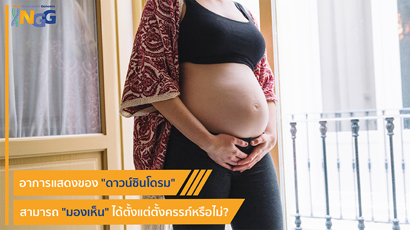 อาการแสดงของดาวน์ซินโดรมสามารถมองเห็นได้ตั้งแต่ตั้งครรภ์หรือไม่?